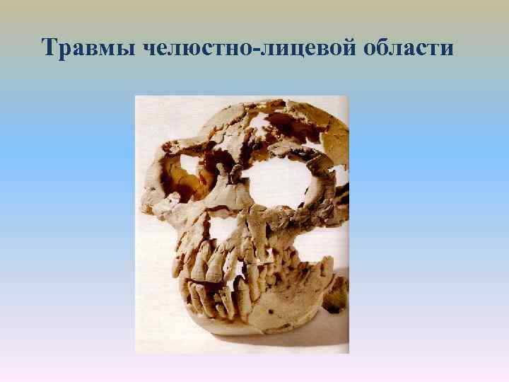 Травмы челюстно-лицевой области 