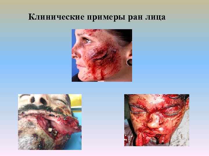 Клинические примеры ран лица 