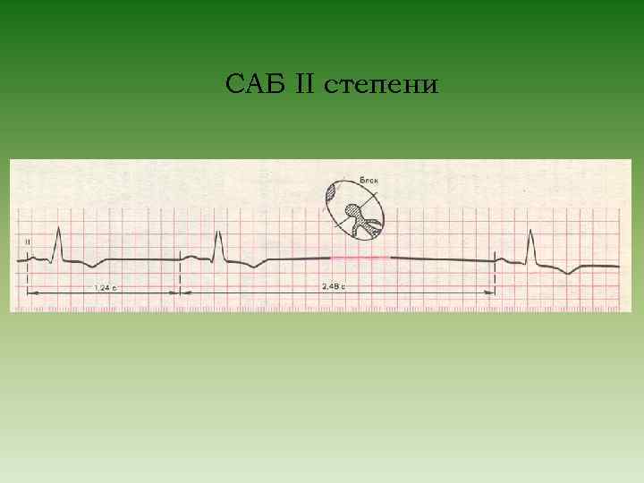 САБ II степени 