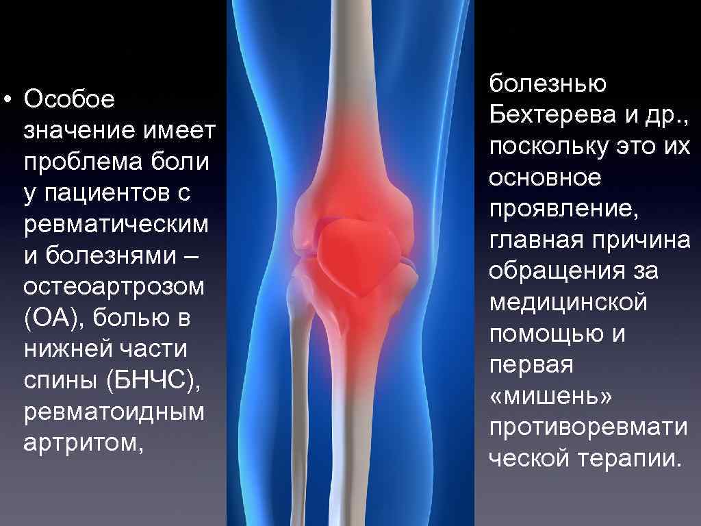  • Особое значение имеет проблема боли у пациентов с ревматическим и болезнями –