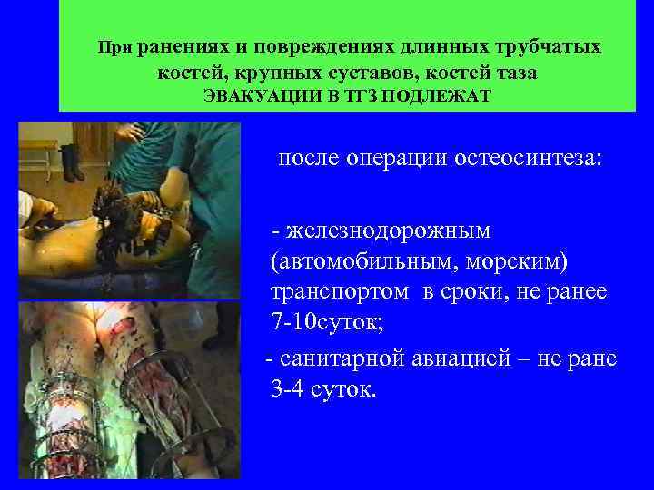 При ранениях и повреждениях длинных трубчатых костей, крупных суставов, костей таза ЭВАКУАЦИИ В ТГЗ