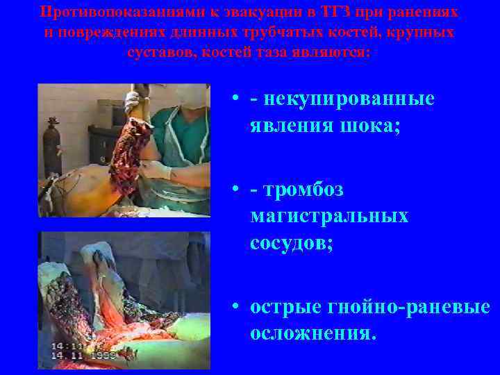 Противопоказаниями к эвакуации в ТГЗ при ранениях и повреждениях длинных трубчатых костей, крупных суставов,