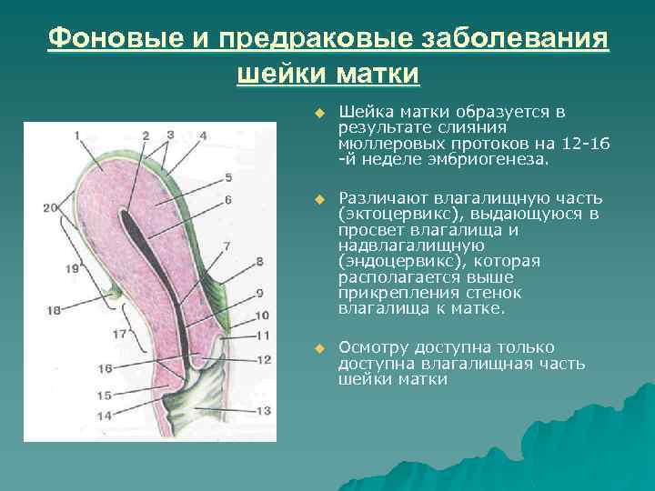 Фоновые и предраковые заболевания шейки матки u Шейка матки образуется в результате слияния мюллеровых