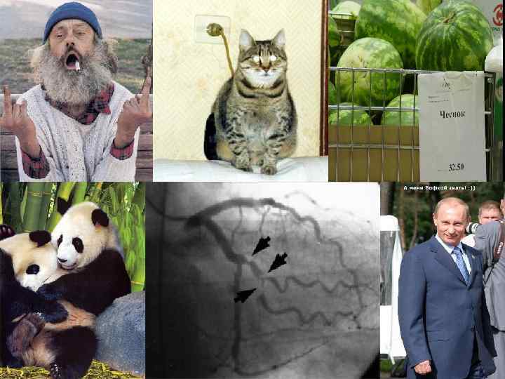 ЭКГ-практикум 