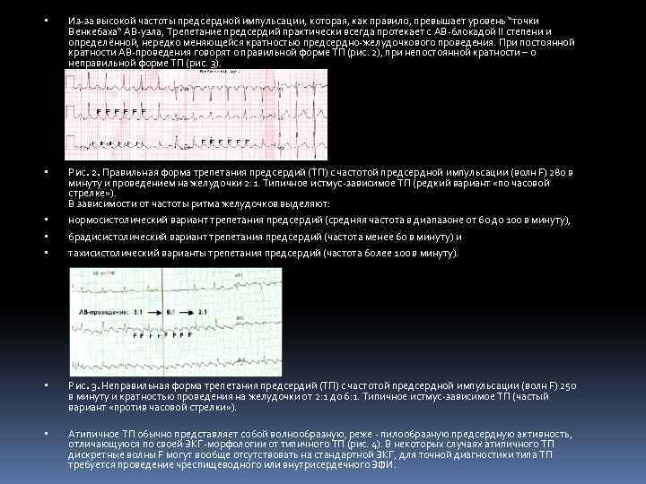  Из-за высокой частоты предсердной импульсации, которая, как правило, превышает уровень “точки Венкебаха“ АВ-узла,