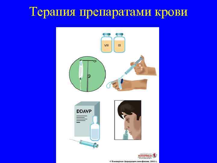 Терапия препаратами крови 