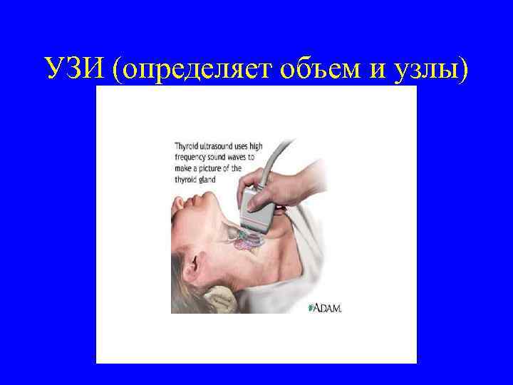 УЗИ (определяет объем и узлы) 