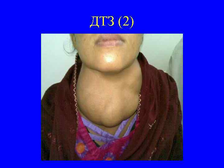 ДТЗ (2) 