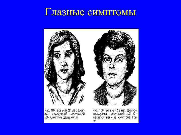 Глазные симптомы 