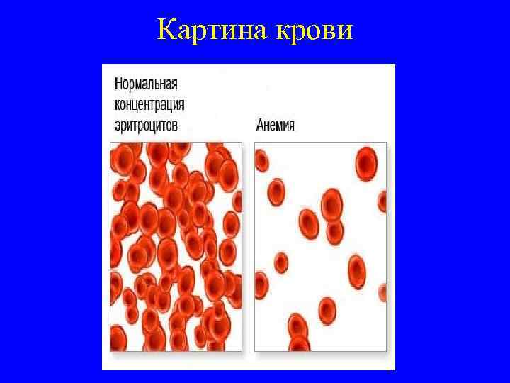 Картина крови 