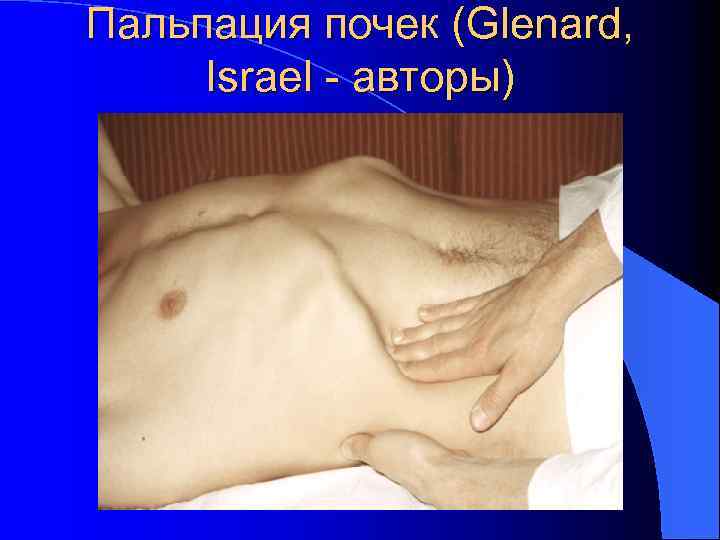 Пальпация почек (Glenard, Israel - авторы) 