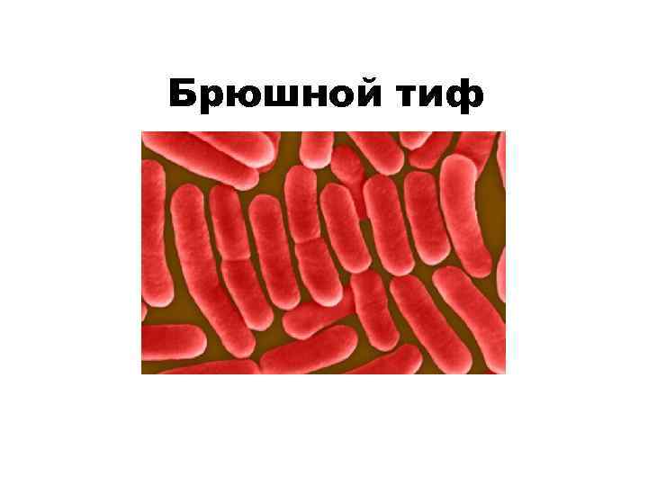 Брюшной тиф 