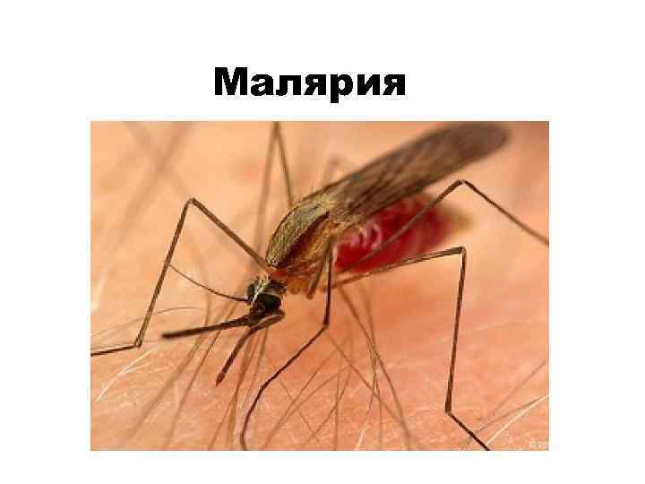 Малярия 