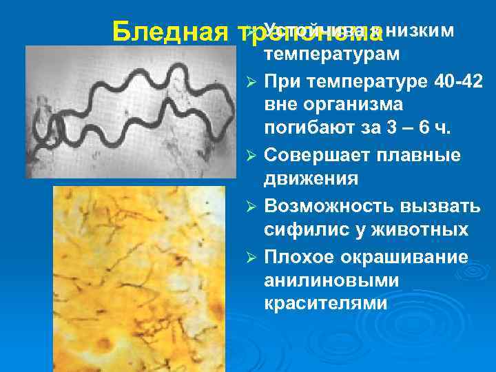 Ø Устойчива к низким Бледная трепонема температурам Ø При температуре 40 -42 вне организма