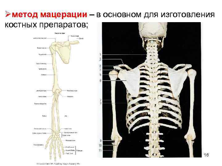 Øметод мацерации – в основном для изготовления костных препаратов; 16 