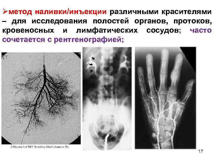 Øметод наливки/инъекции различными красителями – для исследования полостей органов, протоков, кровеносных и лимфатических сосудов;