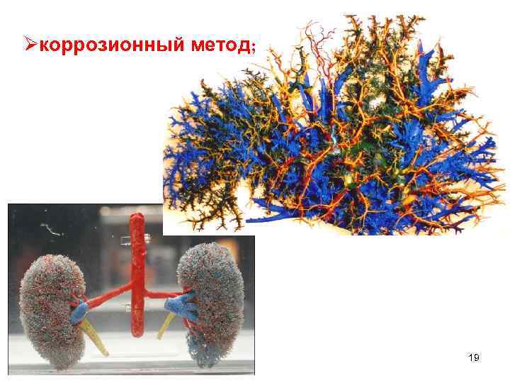 Øкоррозионный метод; 19 