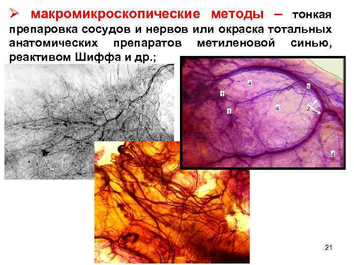 Ø макромикроскопические методы – тонкая препаровка сосудов и нервов или окраска тотальных анатомических препаратов