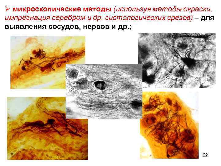 Ø микроскопические методы (используя методы окраски, импрегнация серебром и др. гистологических срезов) – для