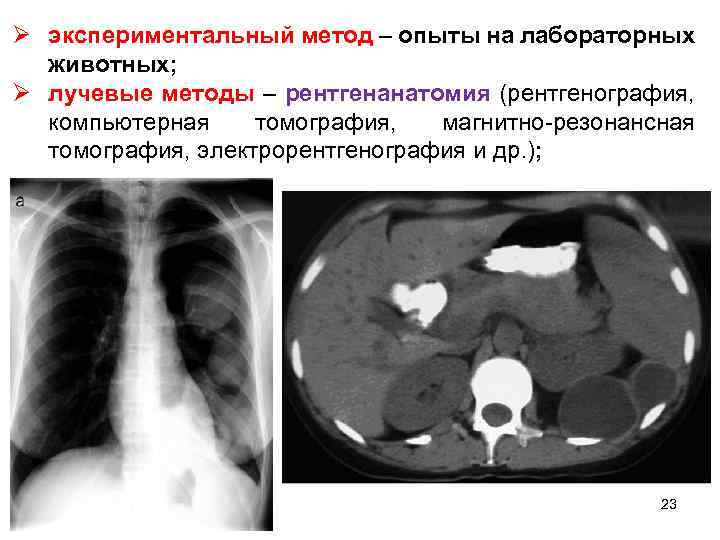 Ø экспериментальный метод – опыты на лабораторных животных; Ø лучевые методы – рентгенанатомия (рентгенография,