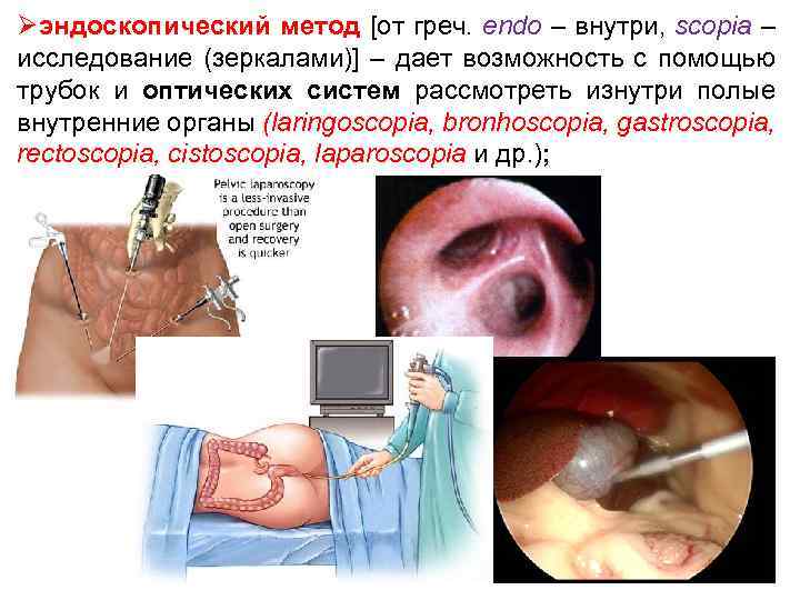 Øэндоскопический метод [от греч. endo – внутри, scopia – исследование (зеркалами)] – дает возможность