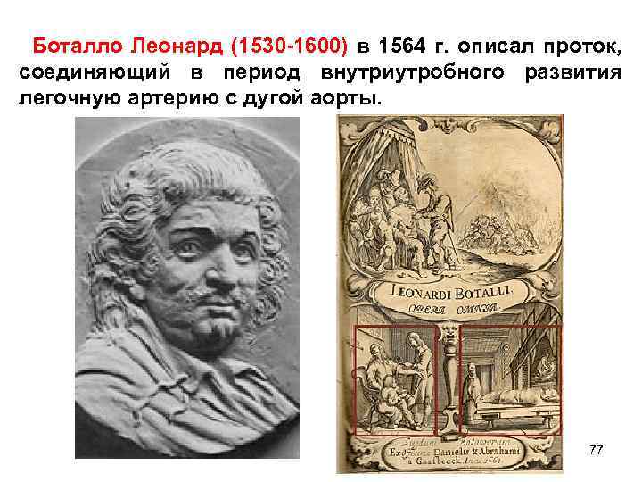 Боталло Леонард (1530 -1600) в 1564 г. описал проток, соединяющий в период внутриутробного развития