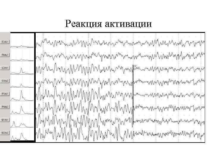 Реакция активации 