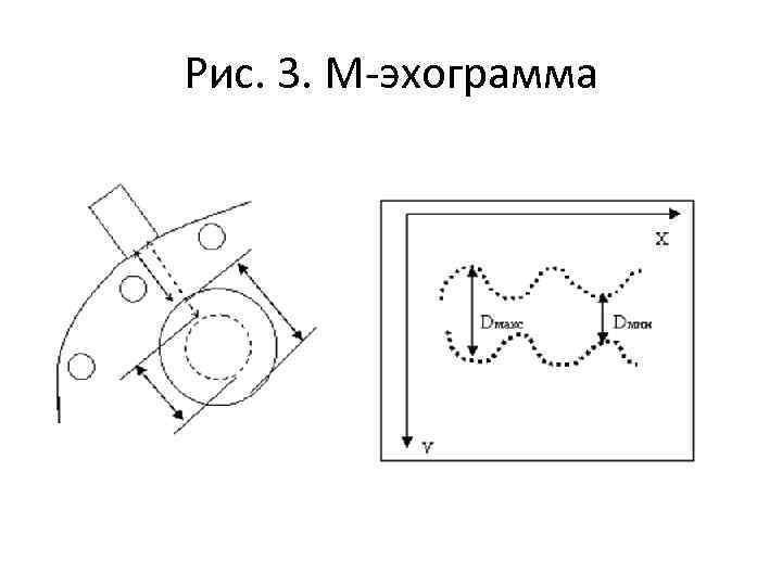 Рис. 3. М эхограмма 