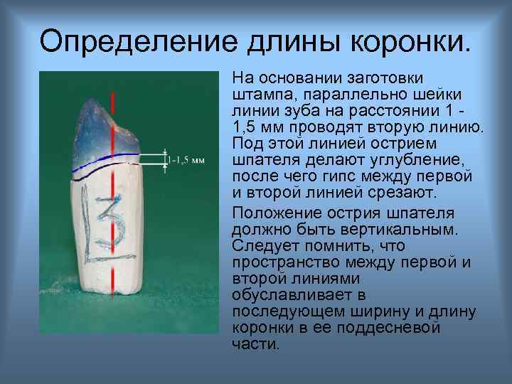 Определение длины коронки. На основании заготовки штампа, параллельно шейки линии зуба на расстоянии 1