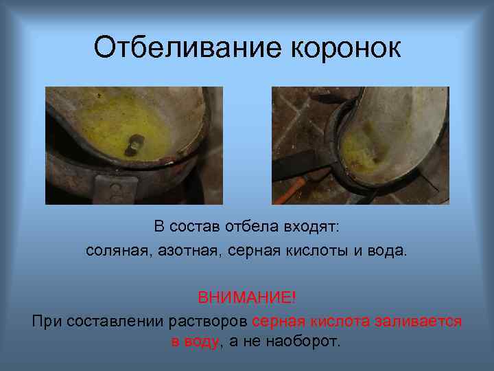 Отбеливание коронок В состав отбела входят: соляная, азотная, серная кислоты и вода. ВНИМАНИЕ! При