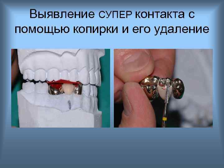 Выявление СУПЕР контакта с помощью копирки и его удаление 