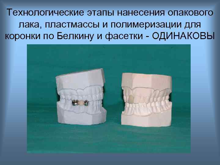 Технологические этапы нанесения опакового лака, пластмассы и полимеризации для коронки по Белкину и фасетки