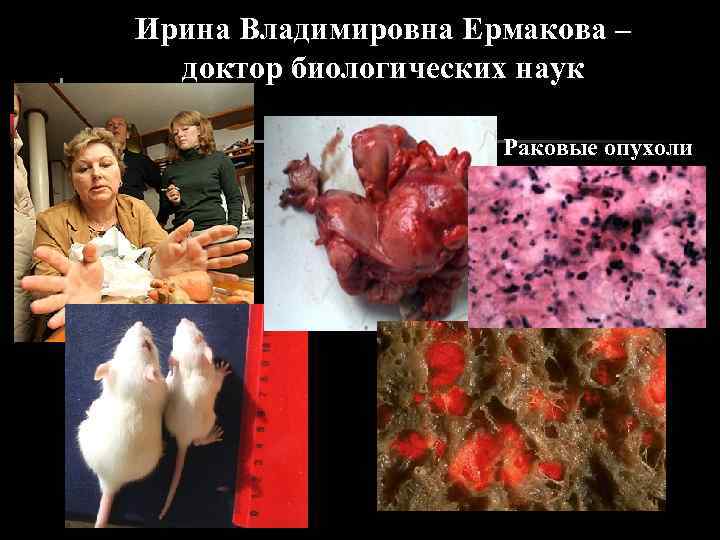 Ирина Владимировна Ермакова – доктор биологических наук Раковые опухоли 
