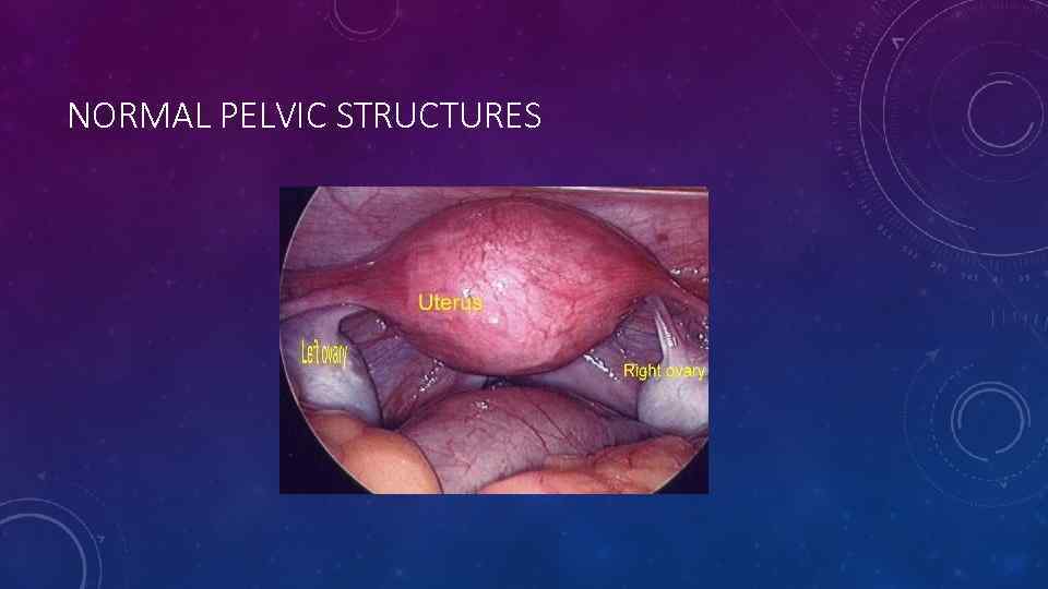 NORMAL PELVIC STRUCTURES 