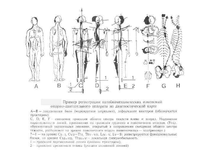 Диагностика по позвоночнику схема