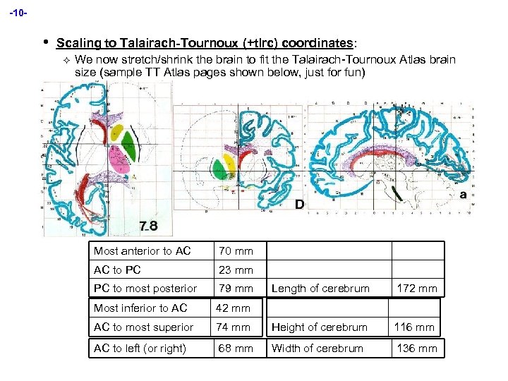 -10 - • Scaling to Talairach-Tournoux (+tlrc) coordinates: ² We now stretch/shrink the brain