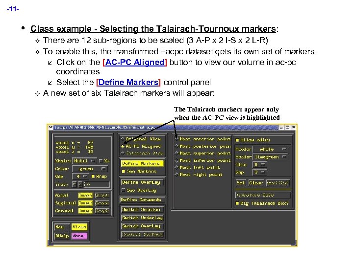 -11 - • Class example - Selecting the Talairach-Tournoux markers: ² ² ² There