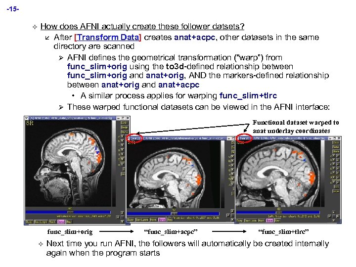 -15² How does AFNI actually create these follower datsets? å After [Transform Data] creates