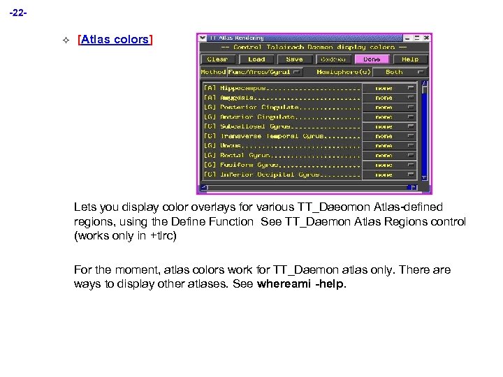 -22² [Atlas colors] Lets you display color overlays for various TT_Daeomon Atlas-defined regions, using