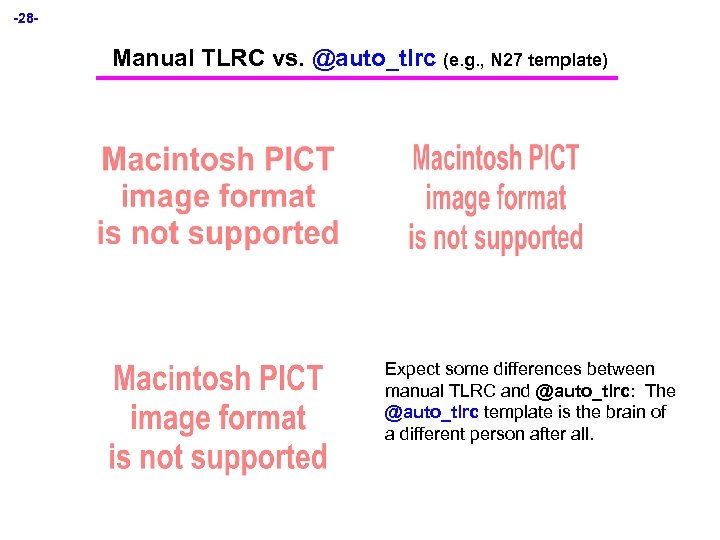 -28 - Manual TLRC vs. @auto_tlrc (e. g. , N 27 template) Expect some