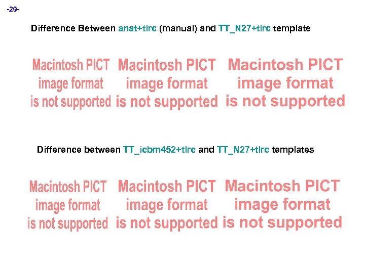 -29 - Difference Between anat+tlrc (manual) and TT_N 27+tlrc template Difference between TT_icbm 452+tlrc