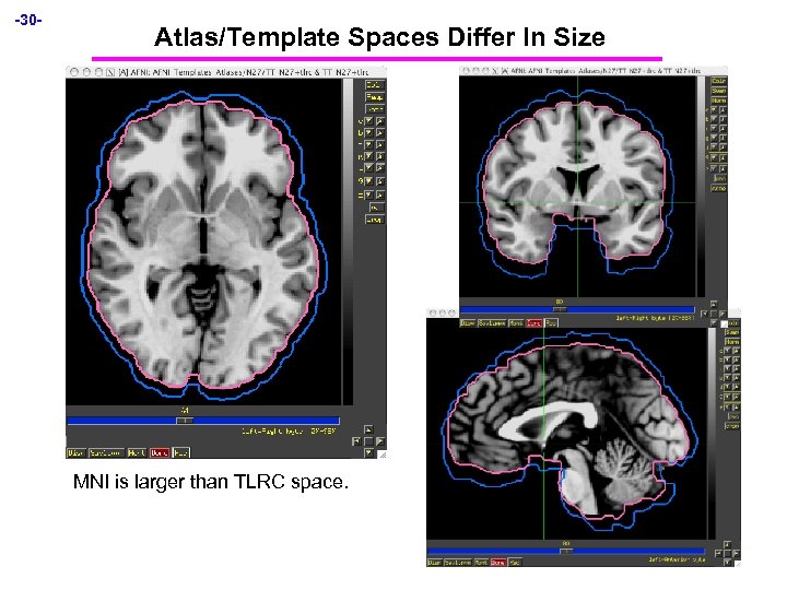 -30 - Atlas/Template Spaces Differ In Size MNI is larger than TLRC space. 