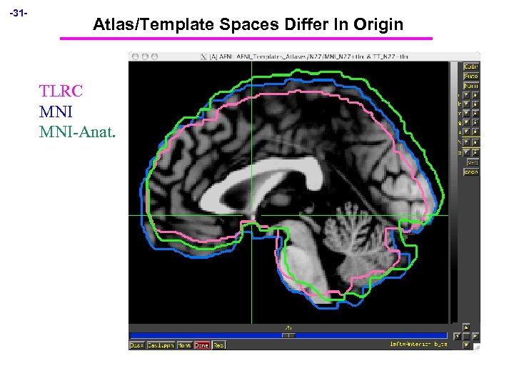 -31 - Atlas/Template Spaces Differ In Origin TLRC MNI-Anat. 