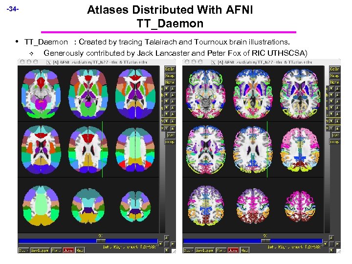 -34 - • Atlases Distributed With AFNI TT_Daemon : Created by tracing Talairach and