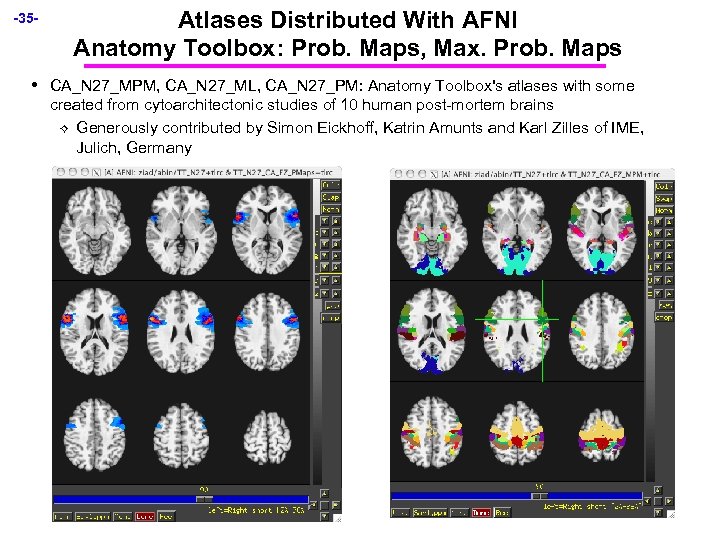 -35 - • Atlases Distributed With AFNI Anatomy Toolbox: Prob. Maps, Max. Prob. Maps