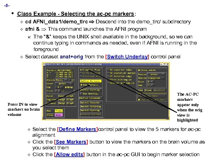 -5 - • Class Example - Selecting the ac-pc markers: ² ² ² cd