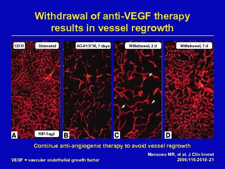Withdrawal of anti-VEGF therapy results in vessel regrowth CD 31 Untreated AG-013736, 7 days