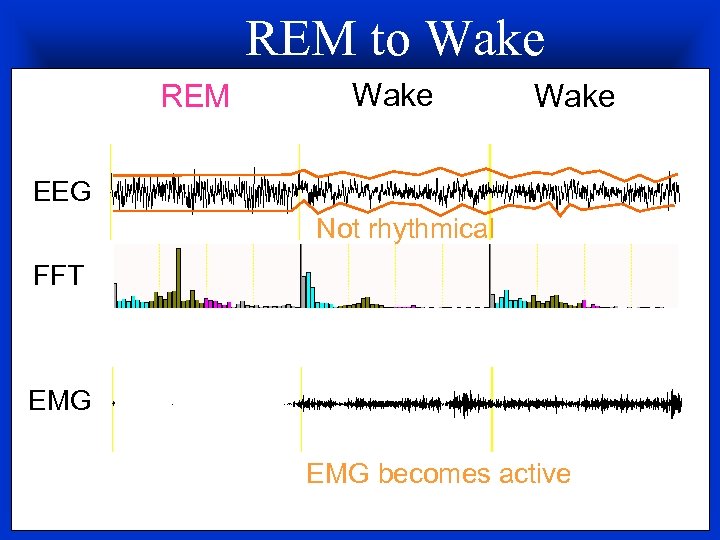 REM to Wake REM Wake EEG Not rhythmical FFT EMG becomes active 