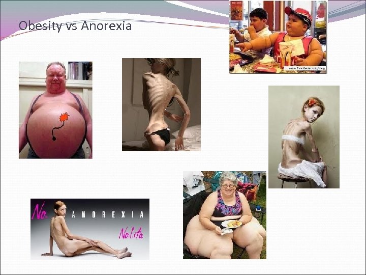 Obesity vs Anorexia 