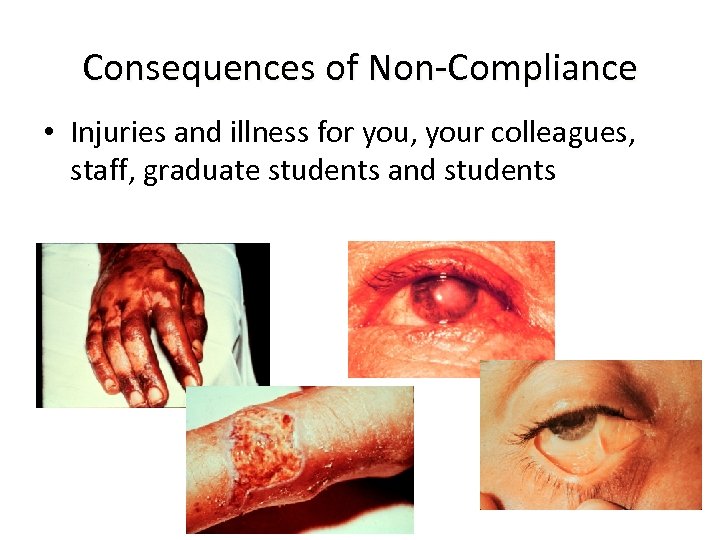 Consequences of Non-Compliance • Injuries and illness for you, your colleagues, staff, graduate students